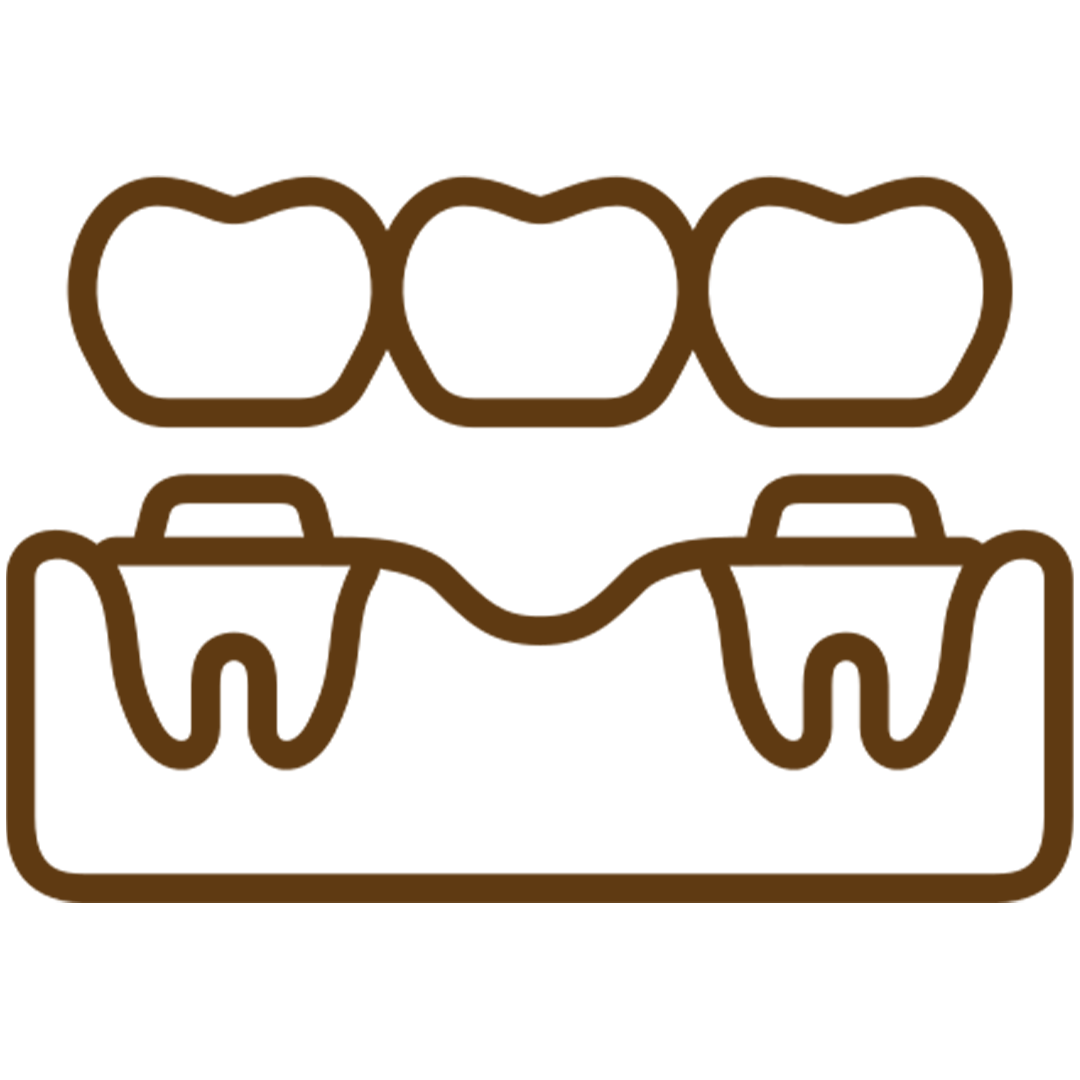 Couronnes et bridges dentaires